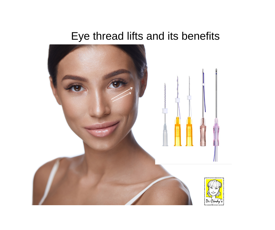 Eye-thread-lifts-and-its-benefits-by-Dr-Cindys-Medical-Aesthetics-