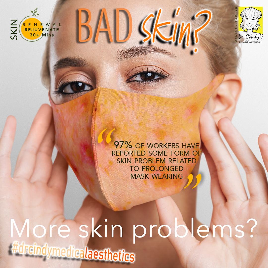 Maskne – How to get rid of acne